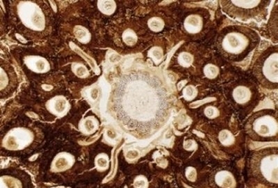 Hallan cromosomas preservados en el fósil de un helecho