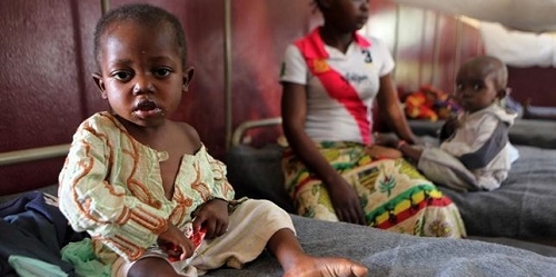UNICEF alerta de que unos 2,8 millones de niños de menos de cinco años mueren cada año por desnutrición