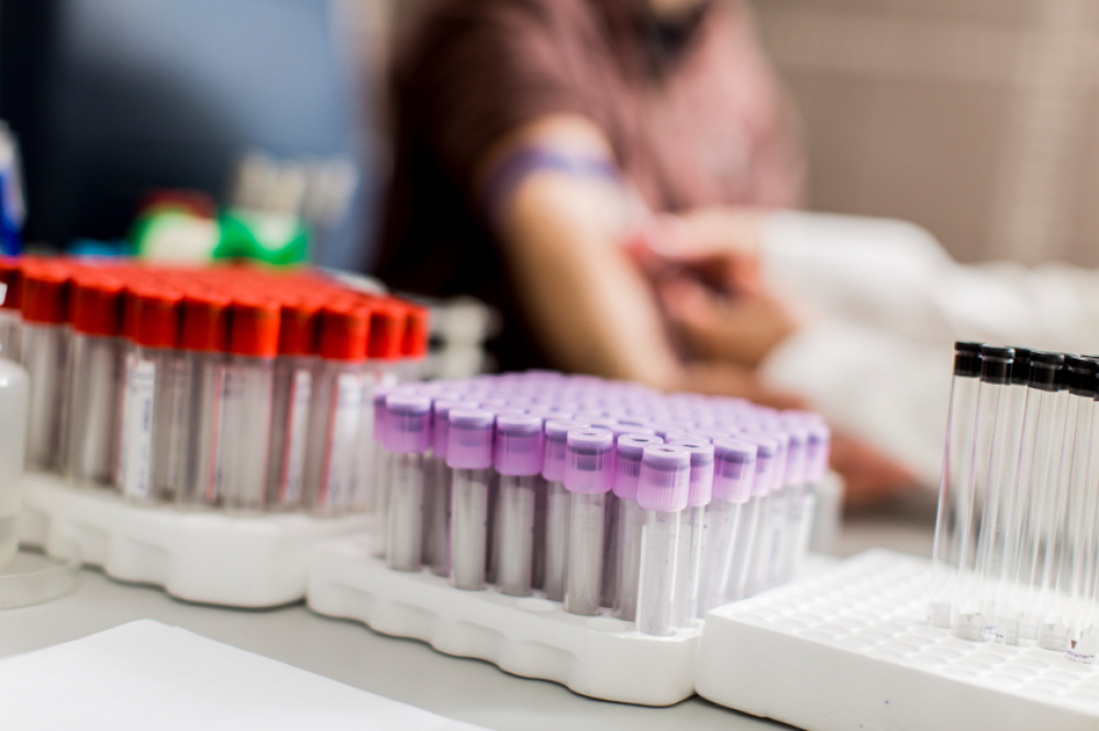 España ha realizado más de 60 millones de pruebas diagnósticas desde el inicio de la epidemia por COVID-19