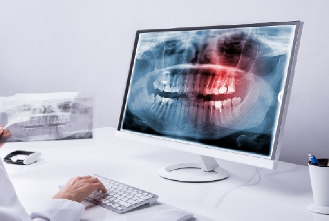 Condena a una clínica odontológica de Manacor por mala praxis en un tratamiento dental