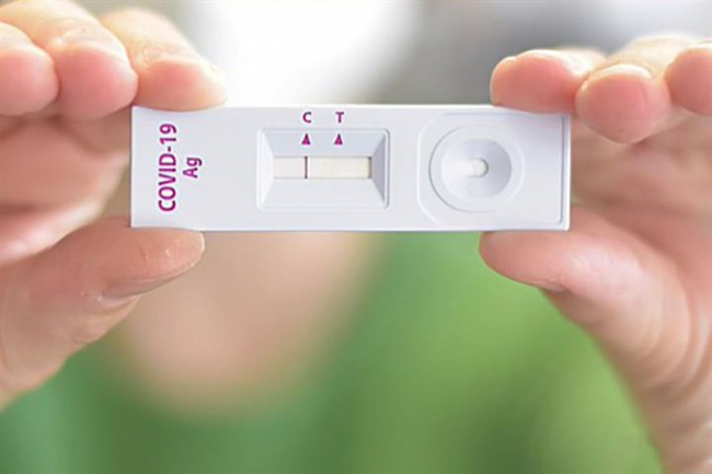 Sanidad ha repartido más de seis millones de test de antígenos de uso profesional a las comunidades y ciudades autónomas
