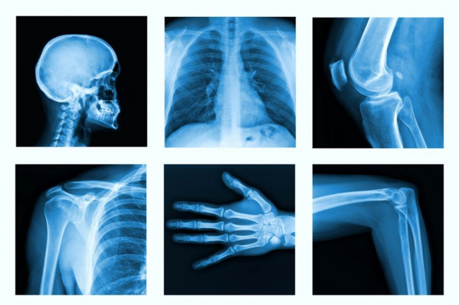 Salud destinará 1,6 millones de euros al matenimiento de los equipos de diagnóstico por imagen del Hospital de Manacor