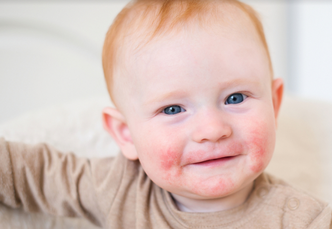 Más de 5.000 dermatólogos crean una web dirigida al ciudadano de consulta y gestión para sus problemas con piel, uñas y pelo